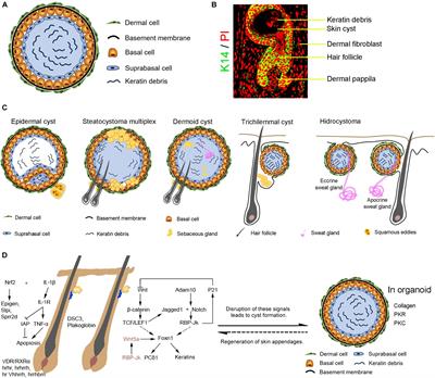 Skin Cyst: A Pathological Dead-End With a New Twist of Morphogenetic Potentials in Organoid Cultures